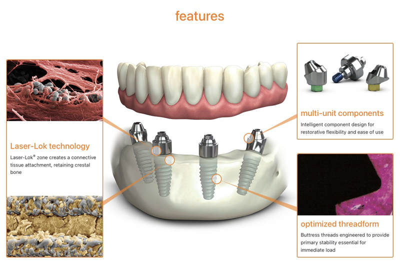 Teethxpress Diagram